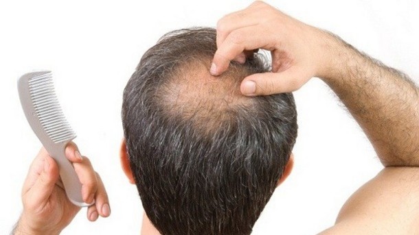 regrow hair bald spots